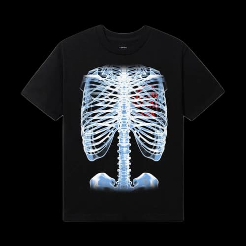Anti Social Social Club Bones Tee 'Black'